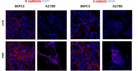 Imágenes confocales de ensayos in vitro, que demuestran que la formulación PRP aumenta la expresión de marcadores de adhesión, cuya expresión está  disminuida en células tumorales.