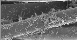 Imagen de microscopía de la tela analizada con bacterias adheridas a las fibras del tejido.