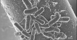 Imagen de carbón activado con bacterias.