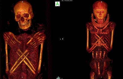 Imágenes de los TAC realizados a dos de las momias.